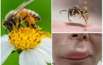 Phải làm gì nếu một con ong bị cắn trong môi
