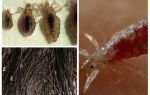 Lice và nits được truyền như thế nào