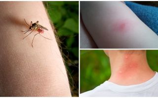 Sự khác biệt giữa muỗi cắn và bọ hoặc bọ chét là gì?