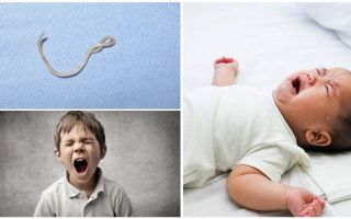 Các triệu chứng và điều trị giun đũa ở trẻ em
