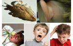 Bệnh pediculosis nguy hiểm là gì