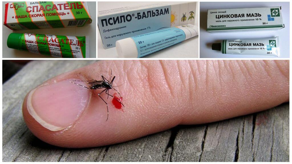 Thuốc mỡ để giảm ngứa do muỗi cắn