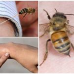 Những lợi ích của ong sting