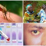 Virus Zika, West Nile và Yellow Fever