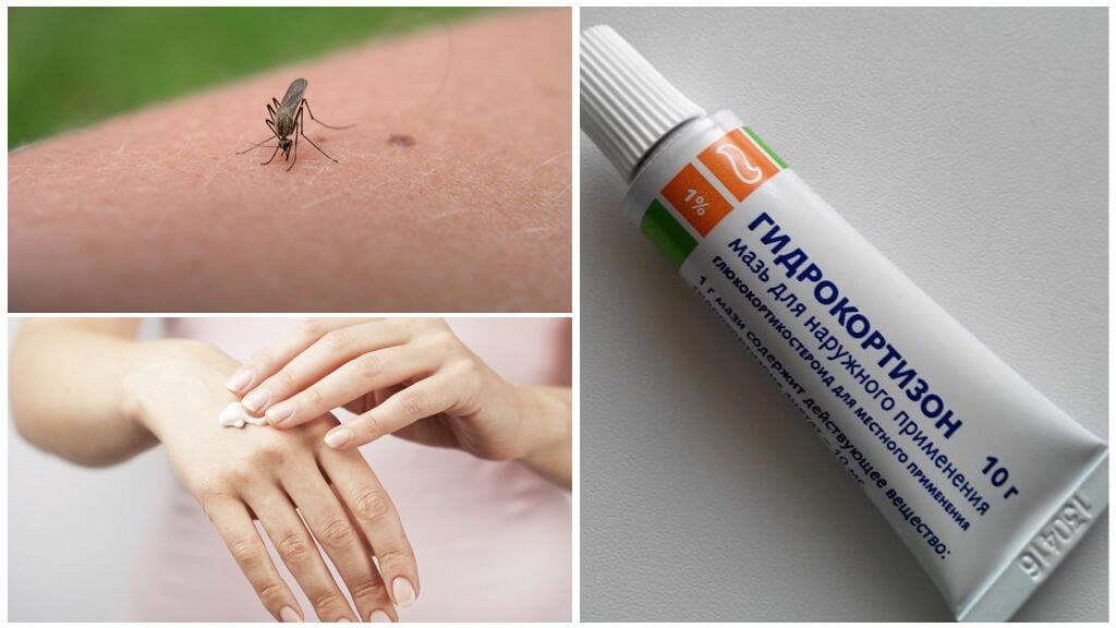 Thuốc mỡ Hydrocortisone cho muỗi đốt