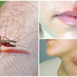 Sốt rét và bệnh sốt rét cho muỗi