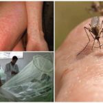 Sốt sốt xuất huyết và Chikungunya