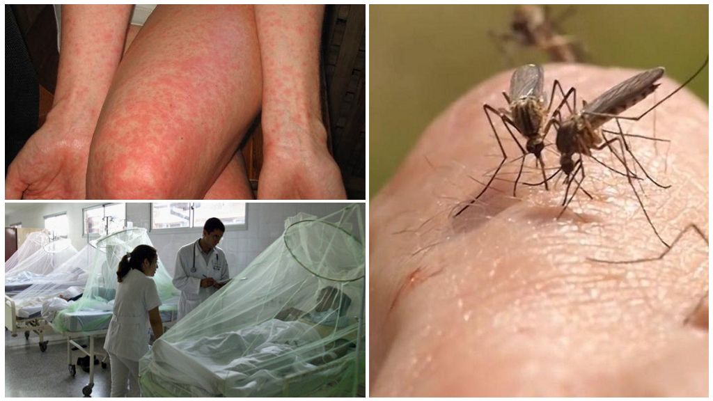 Sốt sốt xuất huyết và Chikungunya